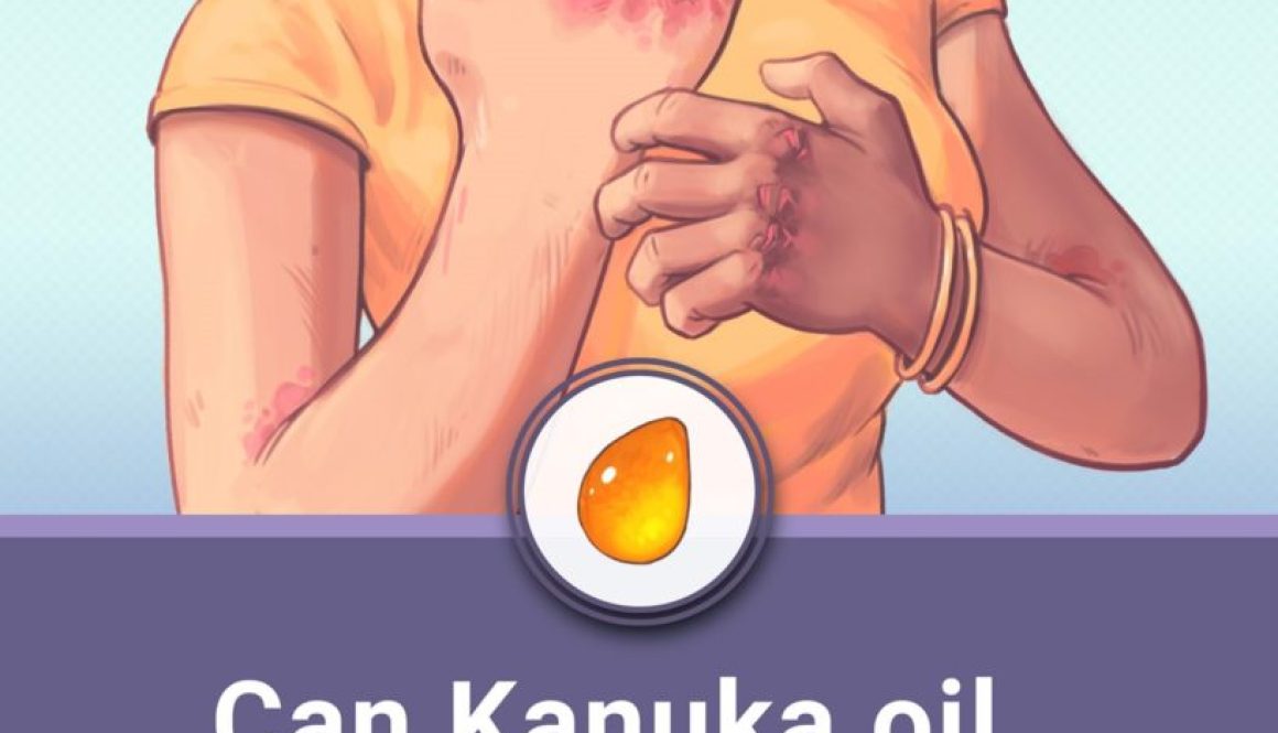 kanuka